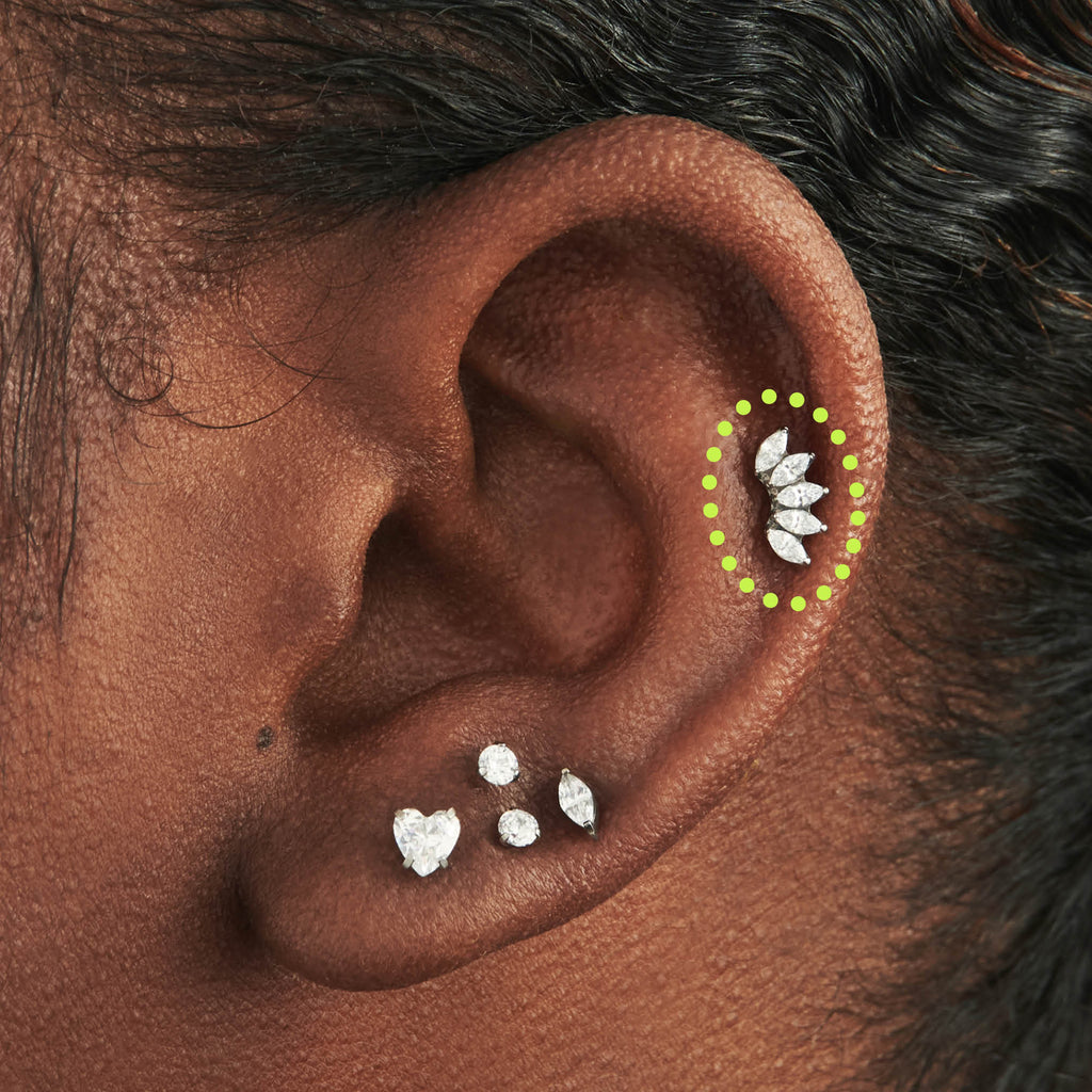 Titanium Crown